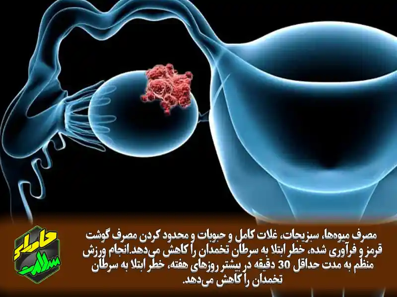 پیشگیری از سرطان تخمدان